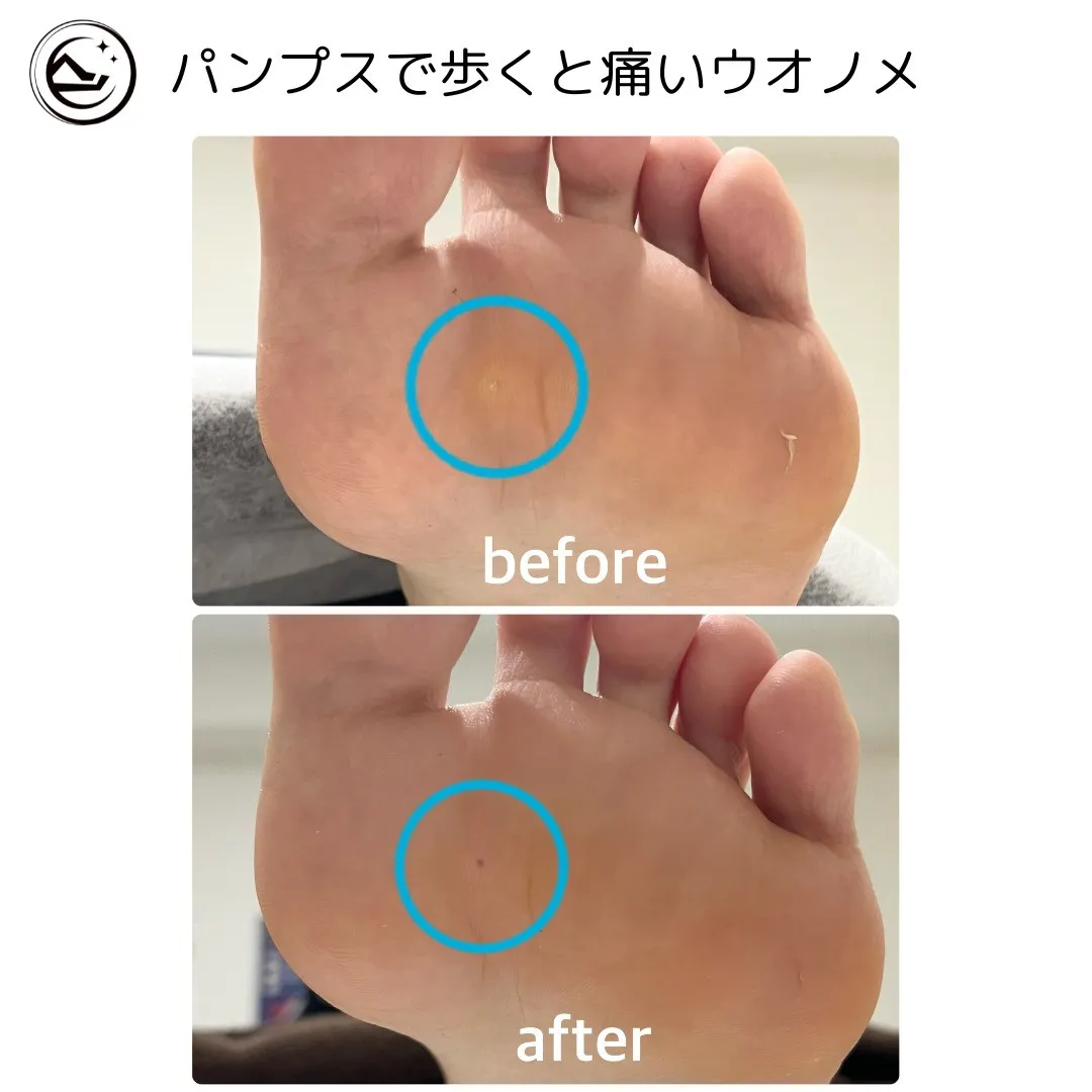 🦶【小さくても、