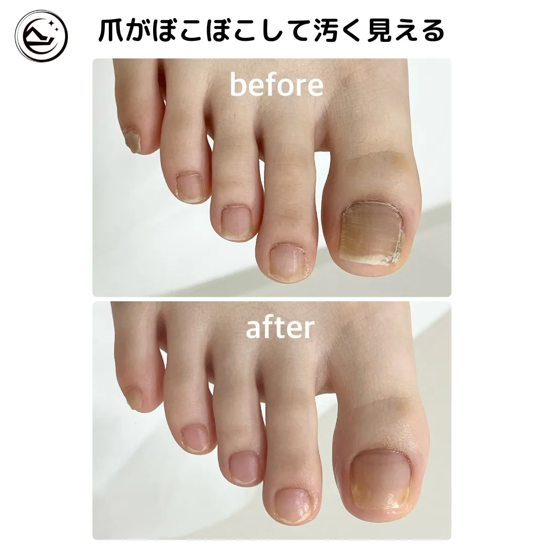 👣【爪がぼこぼこして汚く見える💦】