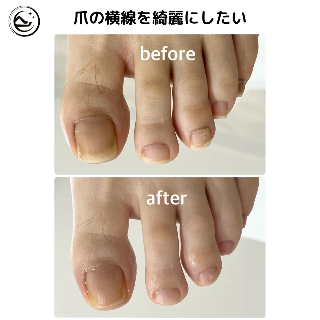 👣【爪に入った“横線”、これって大丈夫？】