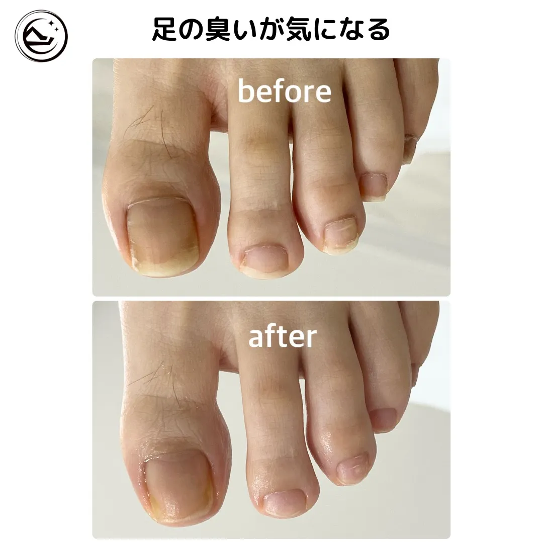 📸【足爪ケア Before→After】📸