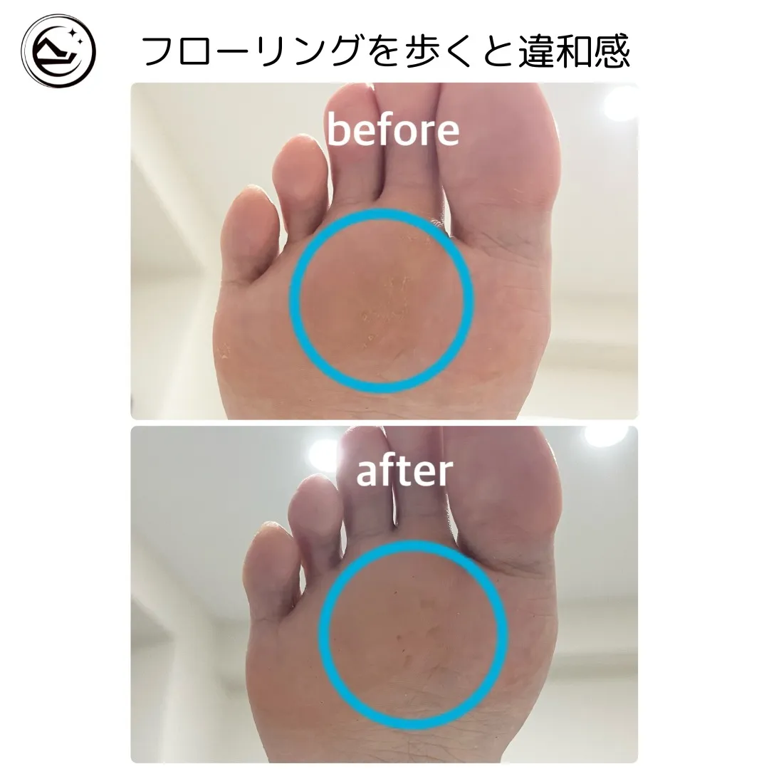 📣【症例Before→After】📣