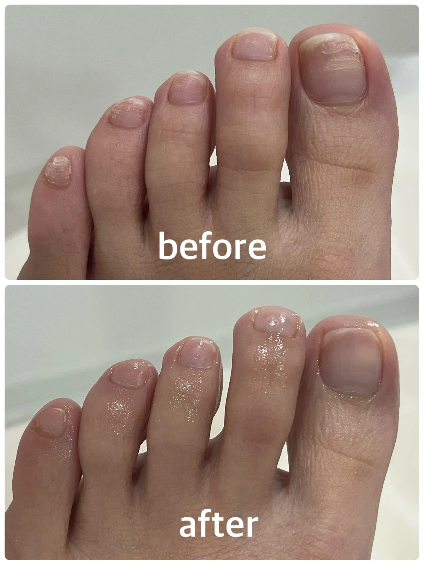 💅【ネイルケア Before → After】💅