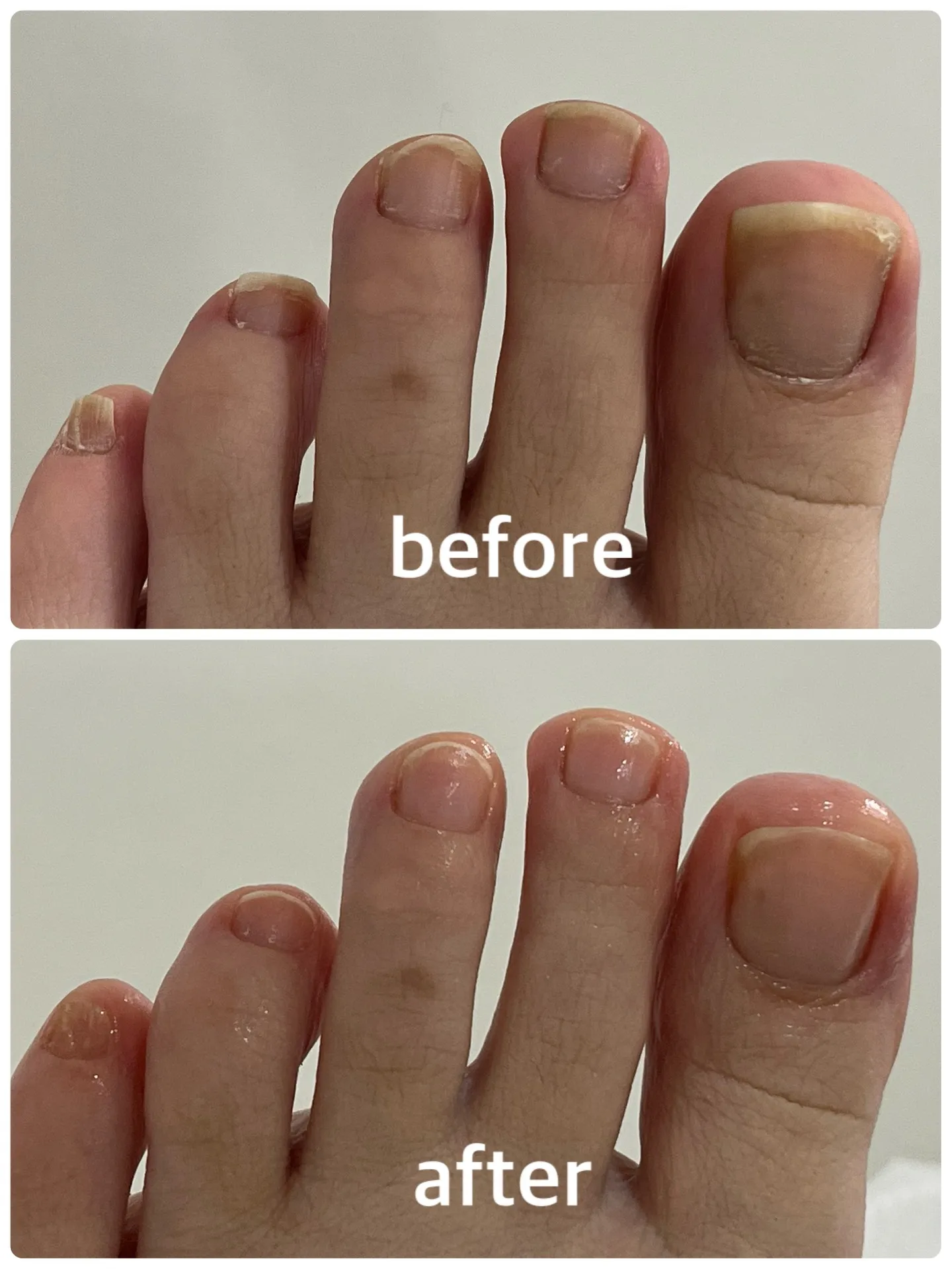 【ネイルケア Before → After】