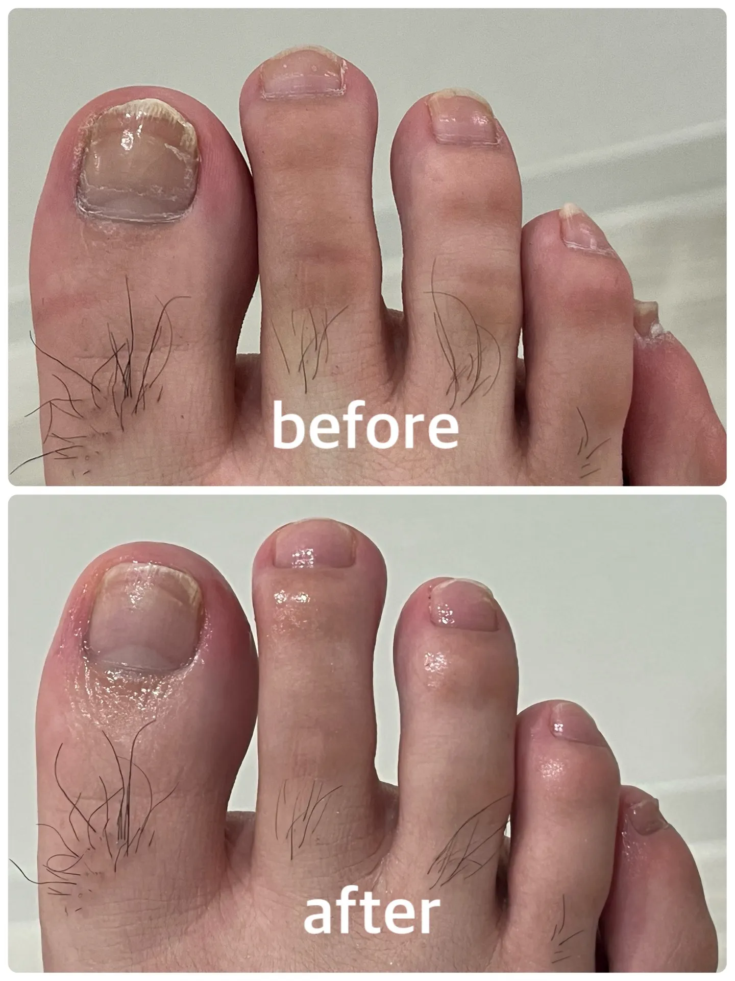 【ネイルケア Before → After】