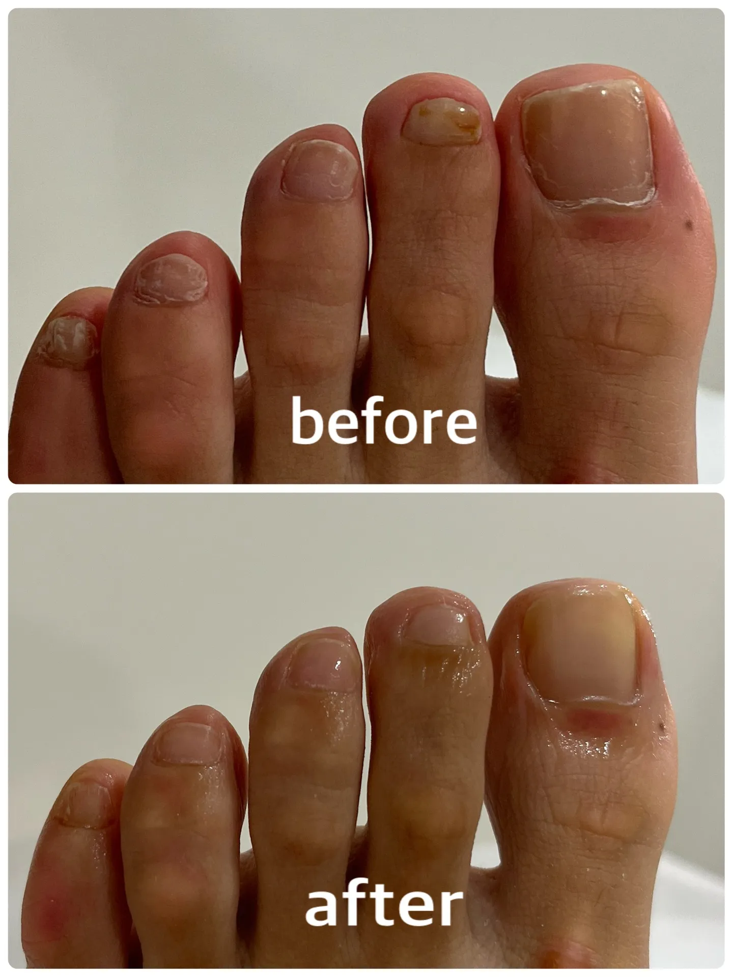 【ネイルケア Before → After】