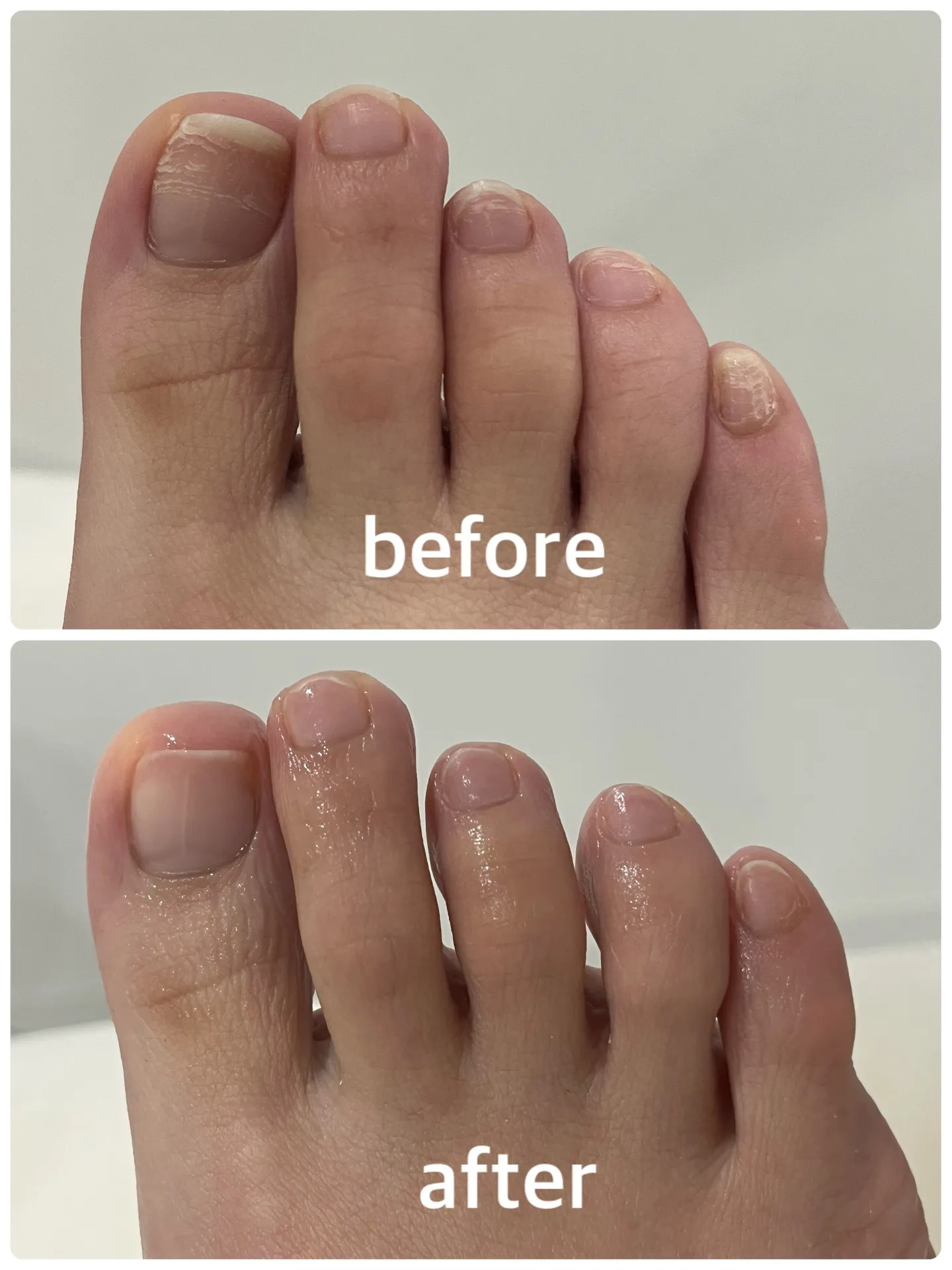 【ネイルケア Before → After】